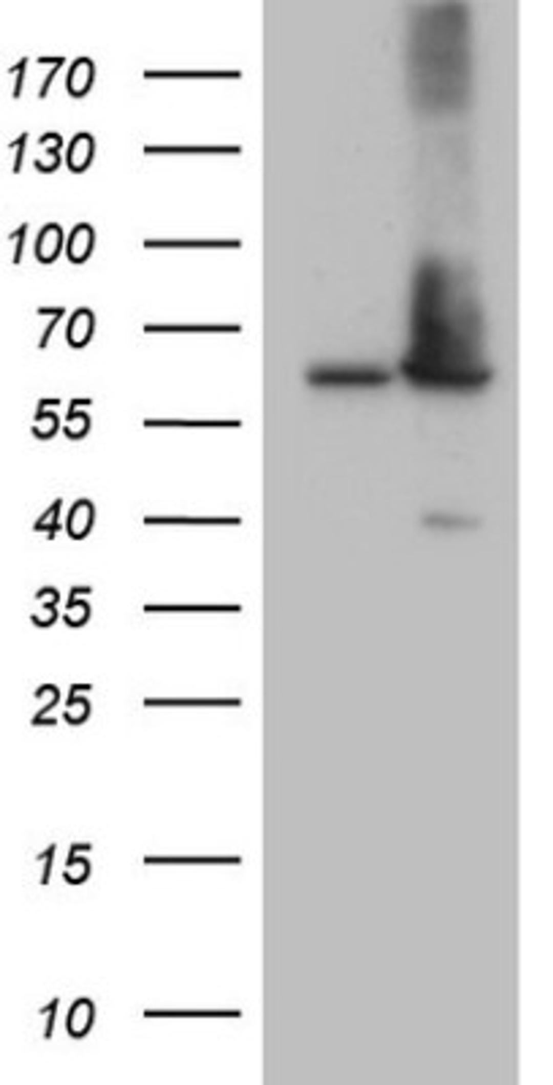 Western Blot: AAAS Antibody (5B10) [NBP2-45540] - Analysis of HEK293T cells were transfected with the pCMV6-ENTRY control (Left lane) or pCMV6-ENTRY AAAS.