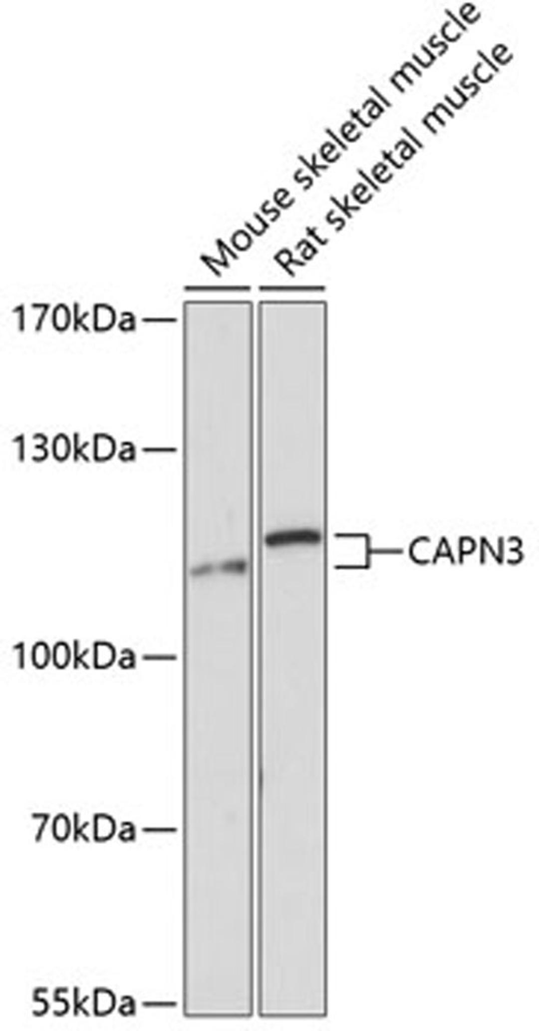 Western blot - CAPN3 Antibody (A11995)