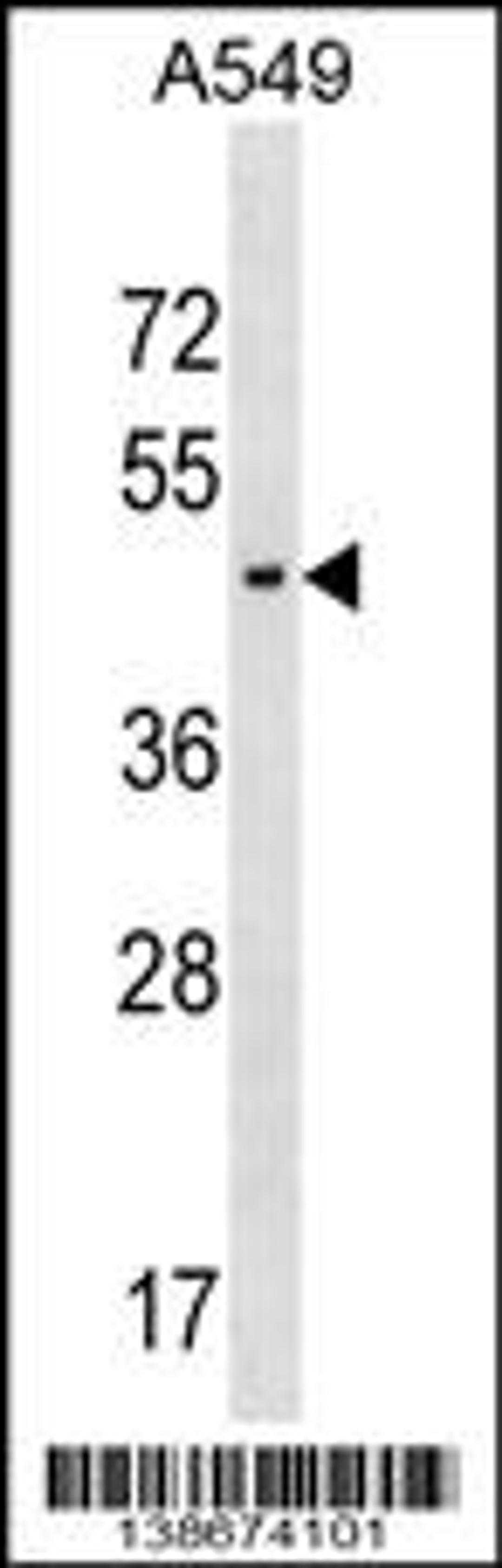 Western blot analysis in A549 cell line lysates (35ug/lane).This demonstrates the AGPAT5 antibody detected the AGPAT5 protein (arrow).