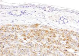 Detection of mouse IDH2 by immunohistochemistry.