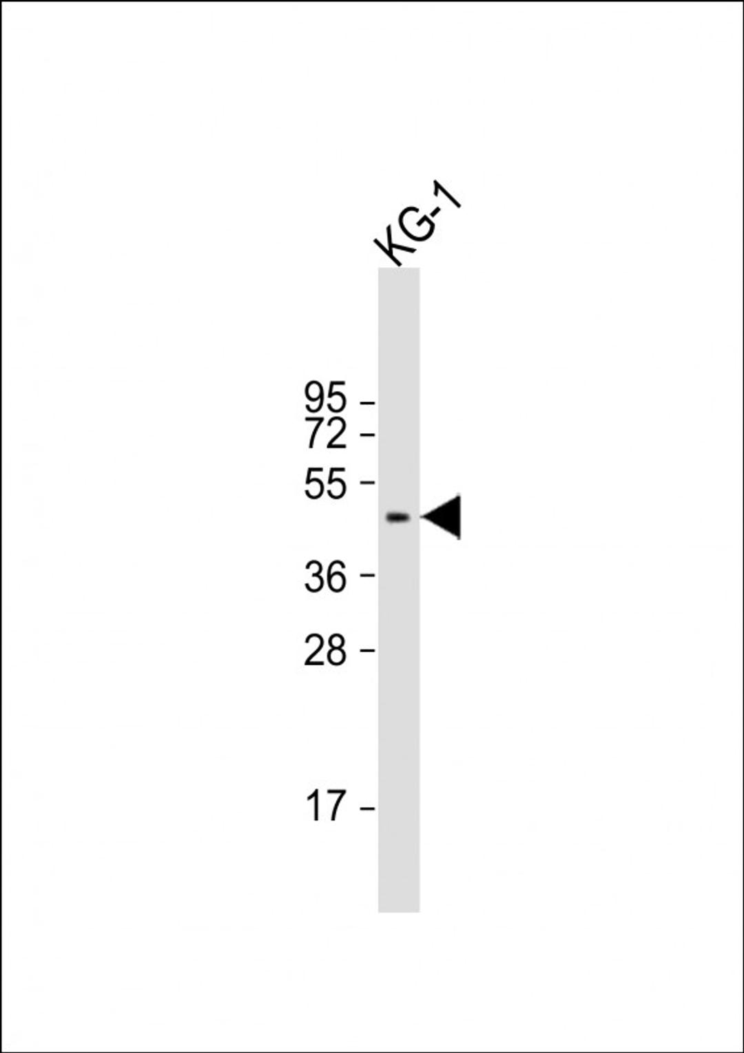 Western Blot at 1:2000 dilution + KG-1 whole cell lysate Lysates/proteins at 20 ug per lane.