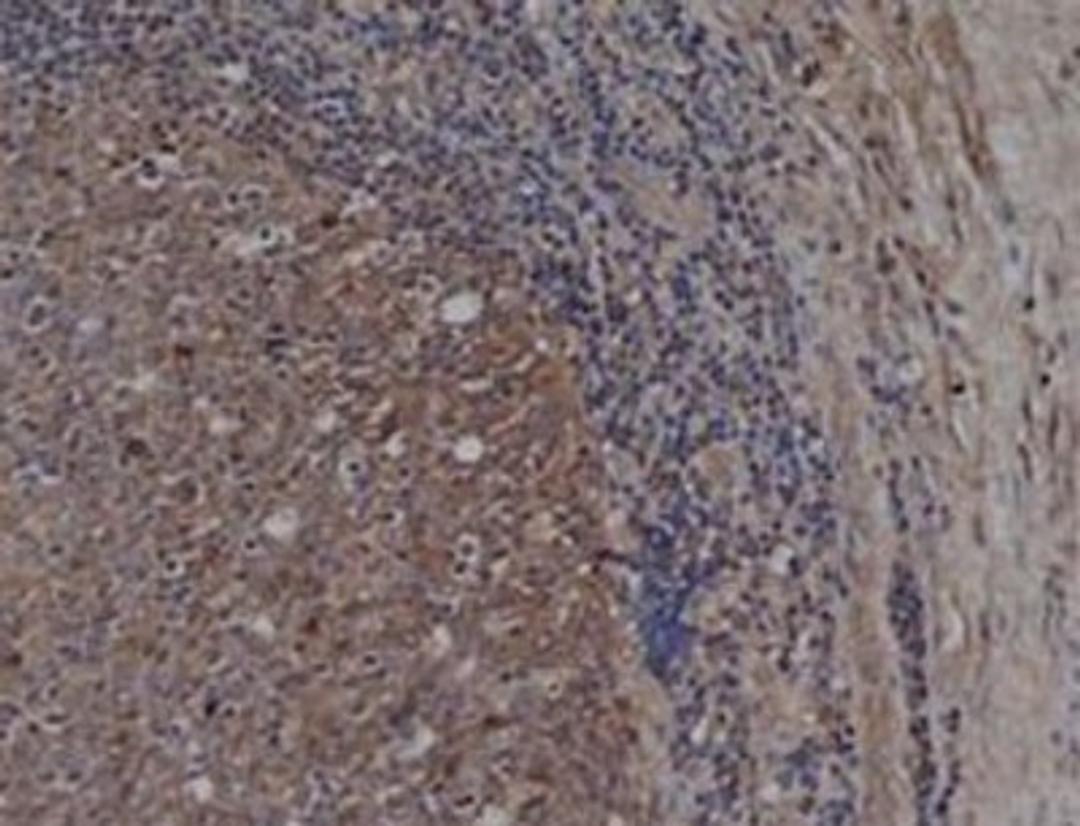 Immunohistochemistry-Paraffin: CD72 Antibody (Bu40) [NB100-64350] - human tonsil with mouse anti human CD72