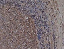 Immunohistochemistry-Paraffin: CD72 Antibody (Bu40) [NB100-64350] - human tonsil with mouse anti human CD72