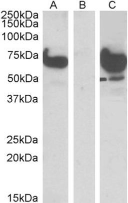 HEK293 lysate (10ug protein in RIPA buffer) overexpressing Human EPM2AIP1 with DYKDDDDK tag probed with 45-547 (1ug/ml) in Lane A and probed with anti-DYKDDDDK Tag (1/1000) in lane C. Mock-transfected HEK293 probed with 45-547 (1mg/ml) in Lane B. Primar