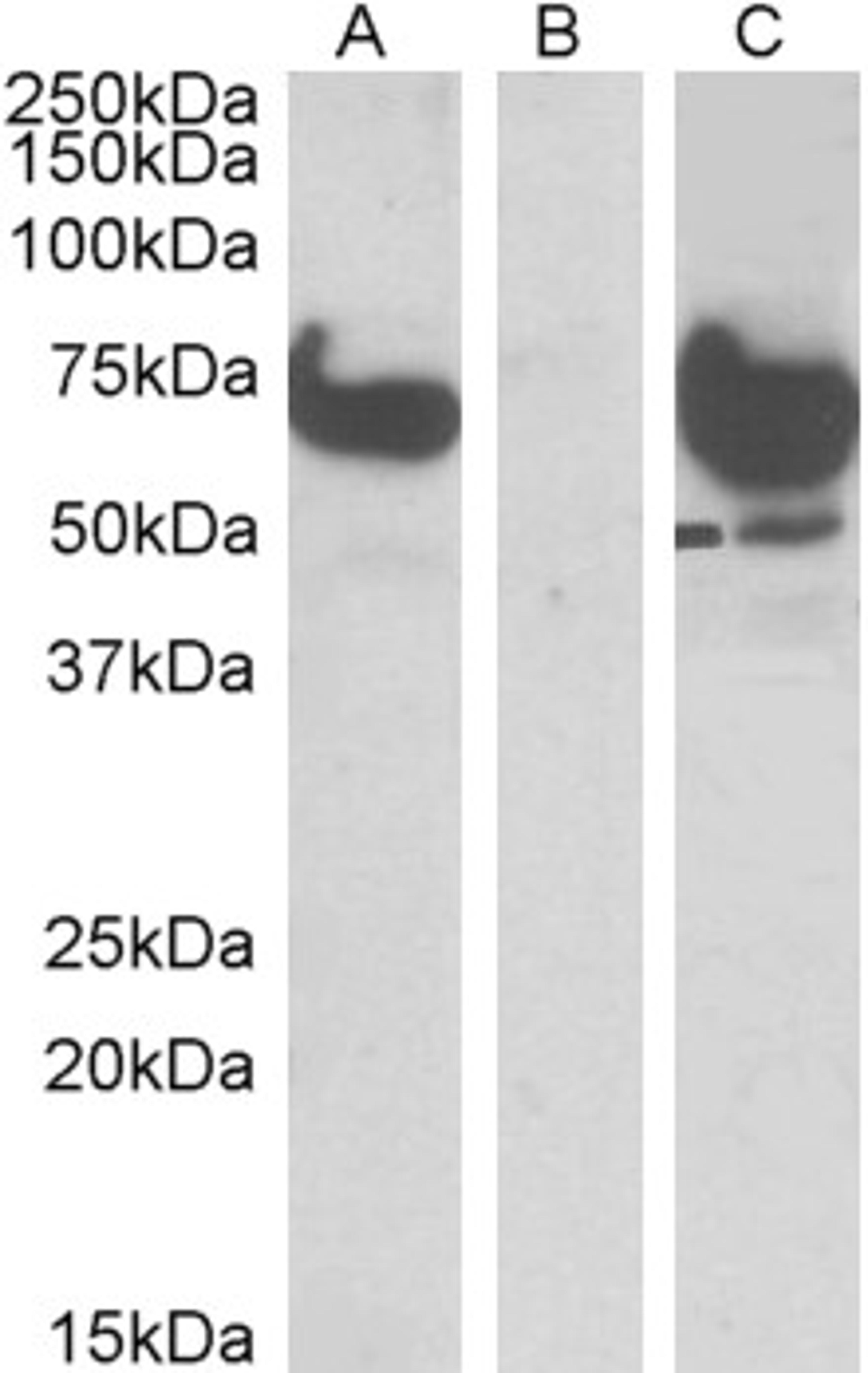 HEK293 lysate (10ug protein in RIPA buffer) overexpressing Human EPM2AIP1 with DYKDDDDK tag probed with 45-547 (1ug/ml) in Lane A and probed with anti-DYKDDDDK Tag (1/1000) in lane C. Mock-transfected HEK293 probed with 45-547 (1mg/ml) in Lane B. Primar