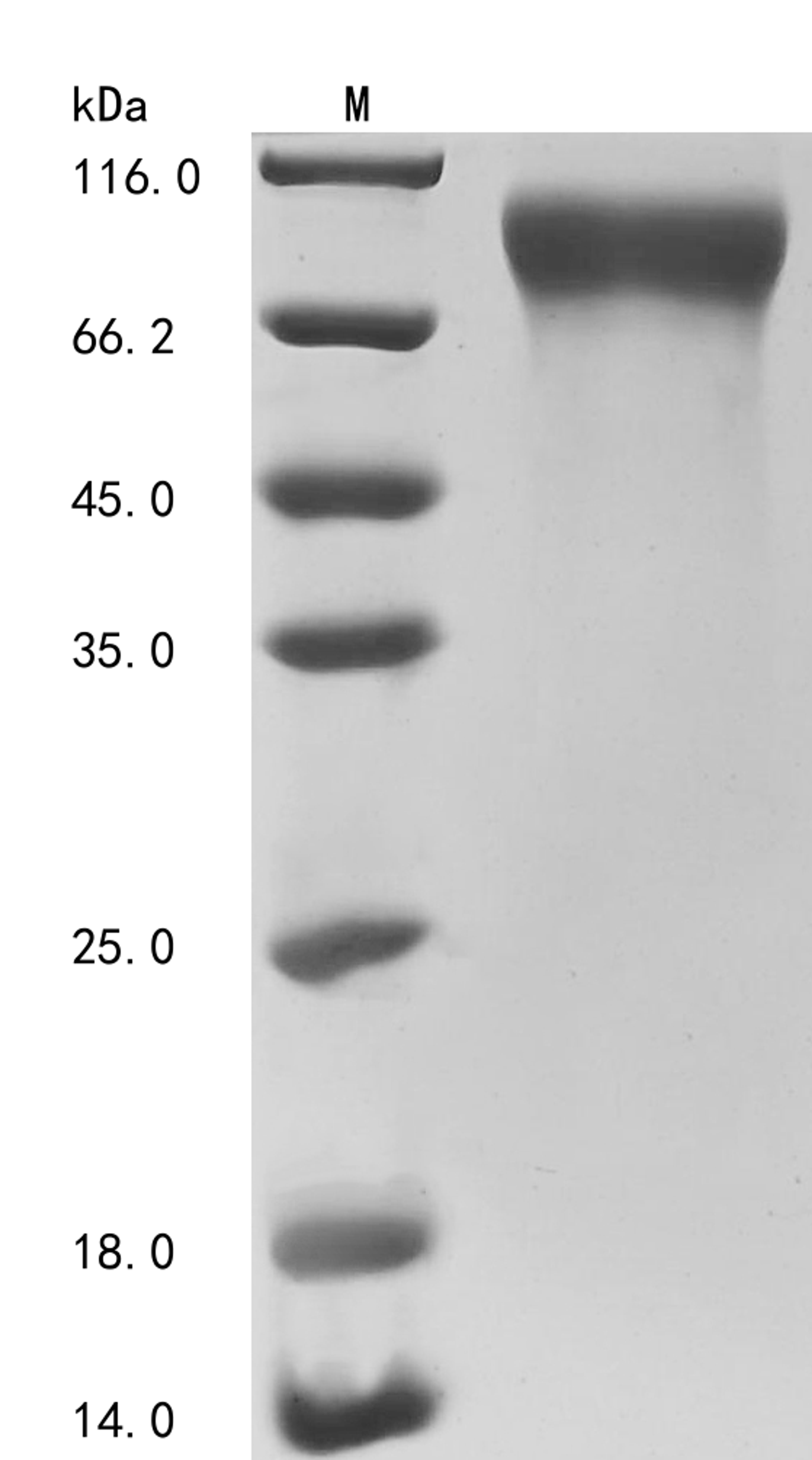 (Tris-Glycine gel) Discontinuous SDS-PAGE (reduced) with 5% enrichment gel and 15% separation gel.