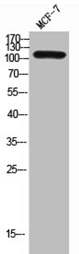 Western Blot analysis of MCF-7 cells using CD249 Polyclonal Antibody