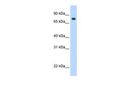 Antibody used in WB on r-STAT1 at 1 ug/ml.