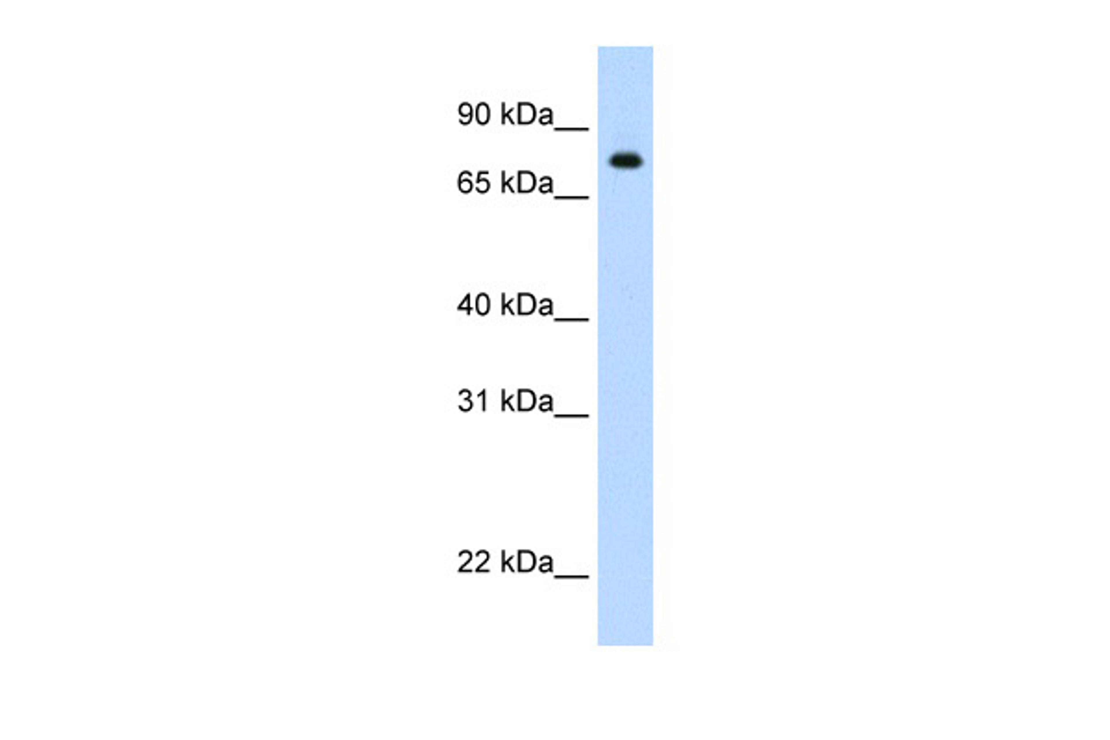 Antibody used in WB on r-STAT1 at 1 ug/ml.