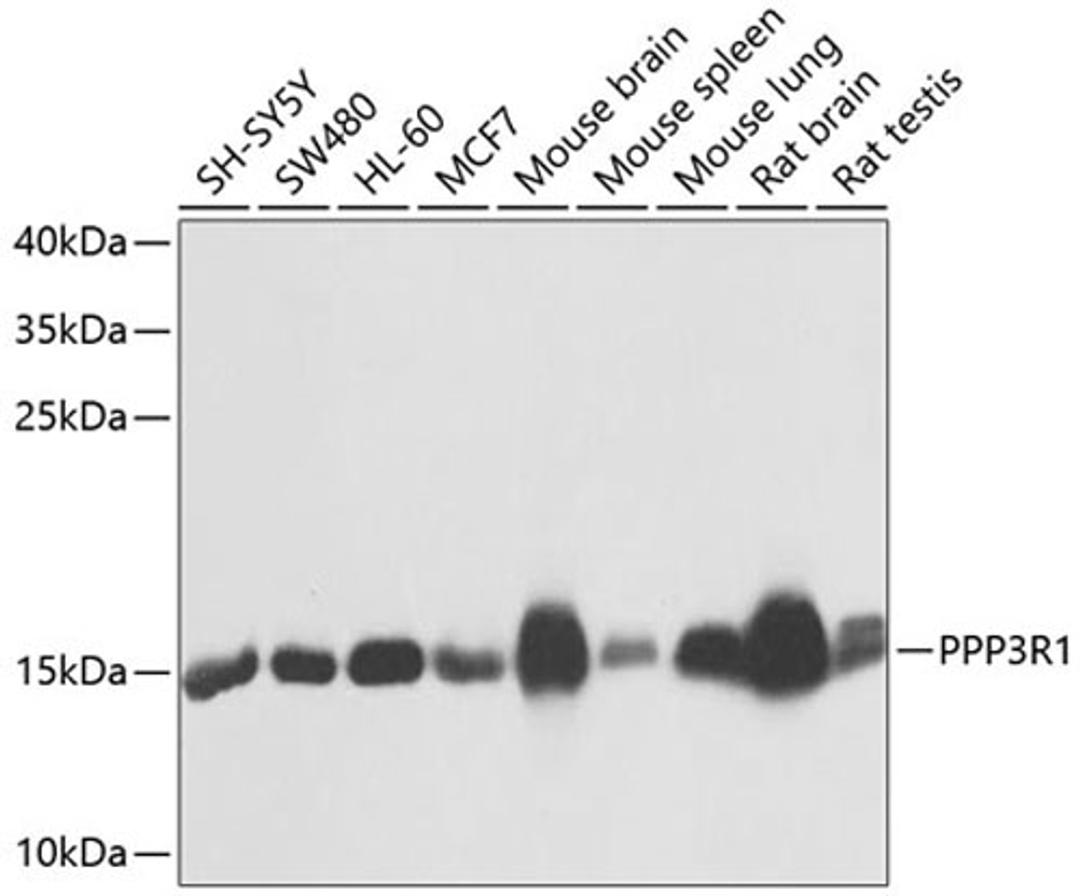 Western blot - PPP3R1 antibody (A0954)