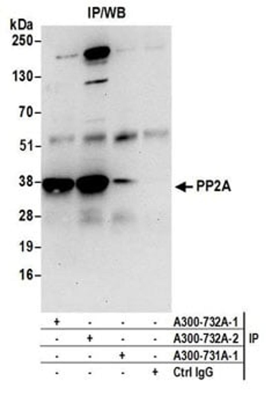 Detection of human PP2A by western blot of immunoprecipitates.