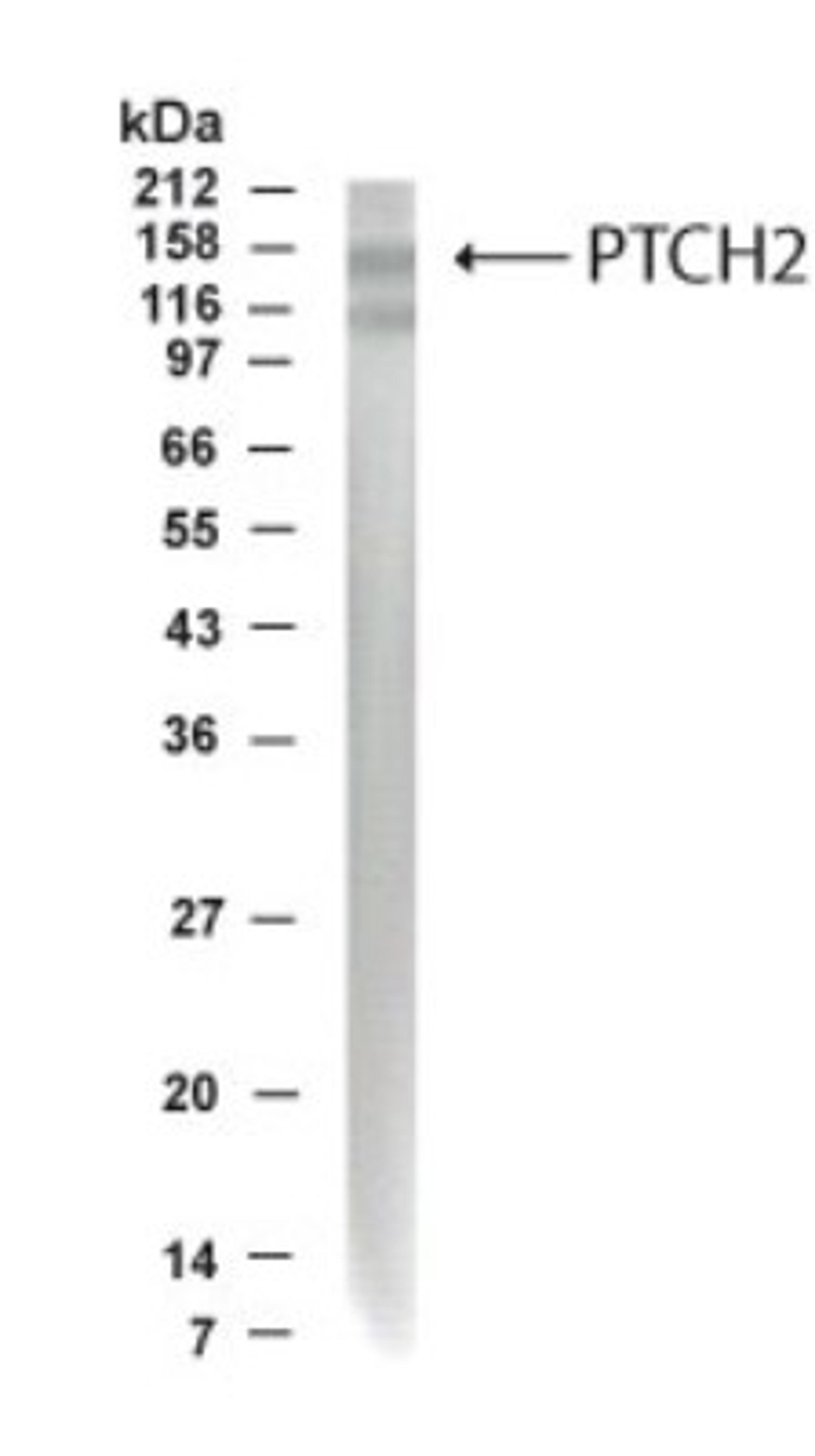 Western Blot: Patched 2 Antibody [NB200-119] - Analysis of human Patched 2 in fetal brain lysate using this antibody at 1:500 dilution.