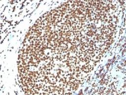 IHC testing of FFPE human tonsil and Histone H1 antibody. Required HIER: boil tissue sections in 10mM citrate buffer, pH 6, for 10-20 min.