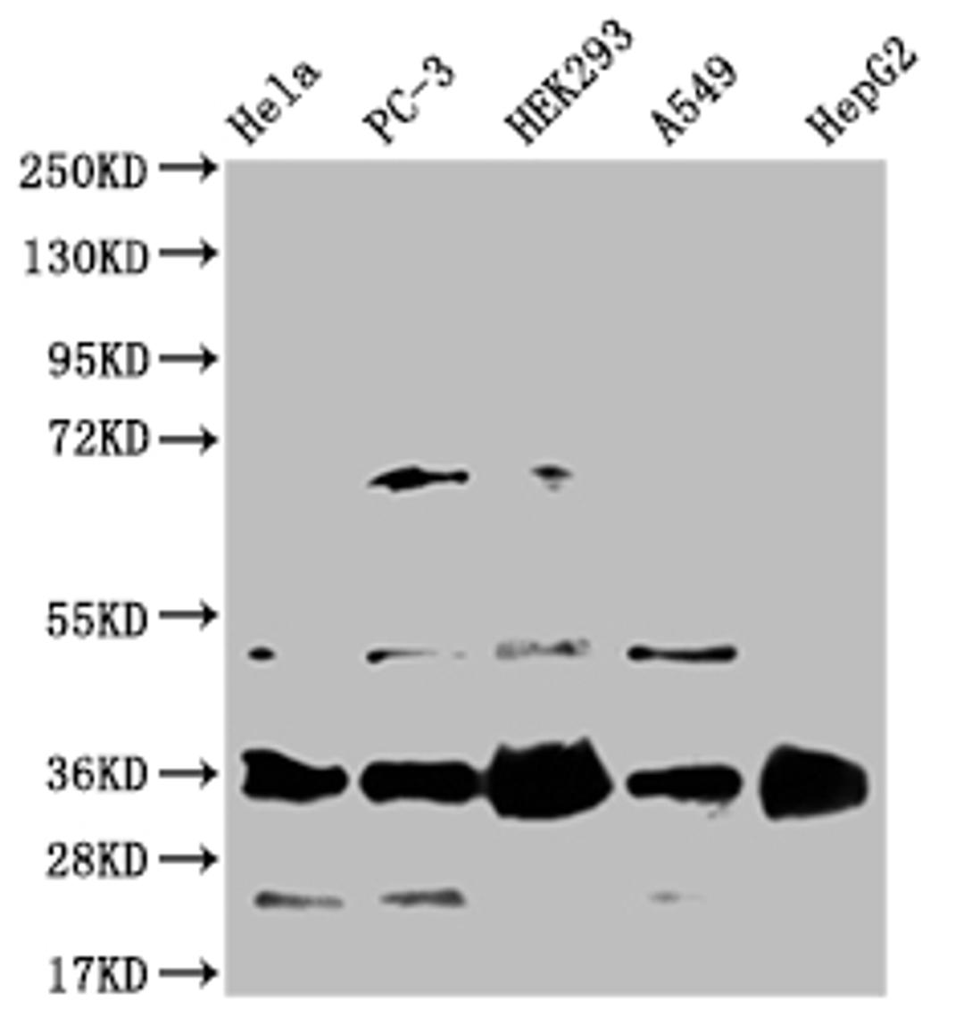 Western Blot. Positive WB detected in: Hela whole cell lysate, PC-3 whole cell lysate, HEK293 whole cell lysate, A549 whole cell lysate, HepG2 whole cell lysate. All lanes: HMGCL antibody at 1:1000. Secondary. Goat polyclonal to rabbit IgG at 1/50000 dilution. Predicted band size: 35, 27, 21 kDa. Observed band size: 35 kDa. 