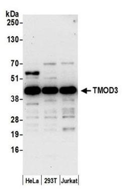 Detection of human TMOD3 by western blot.