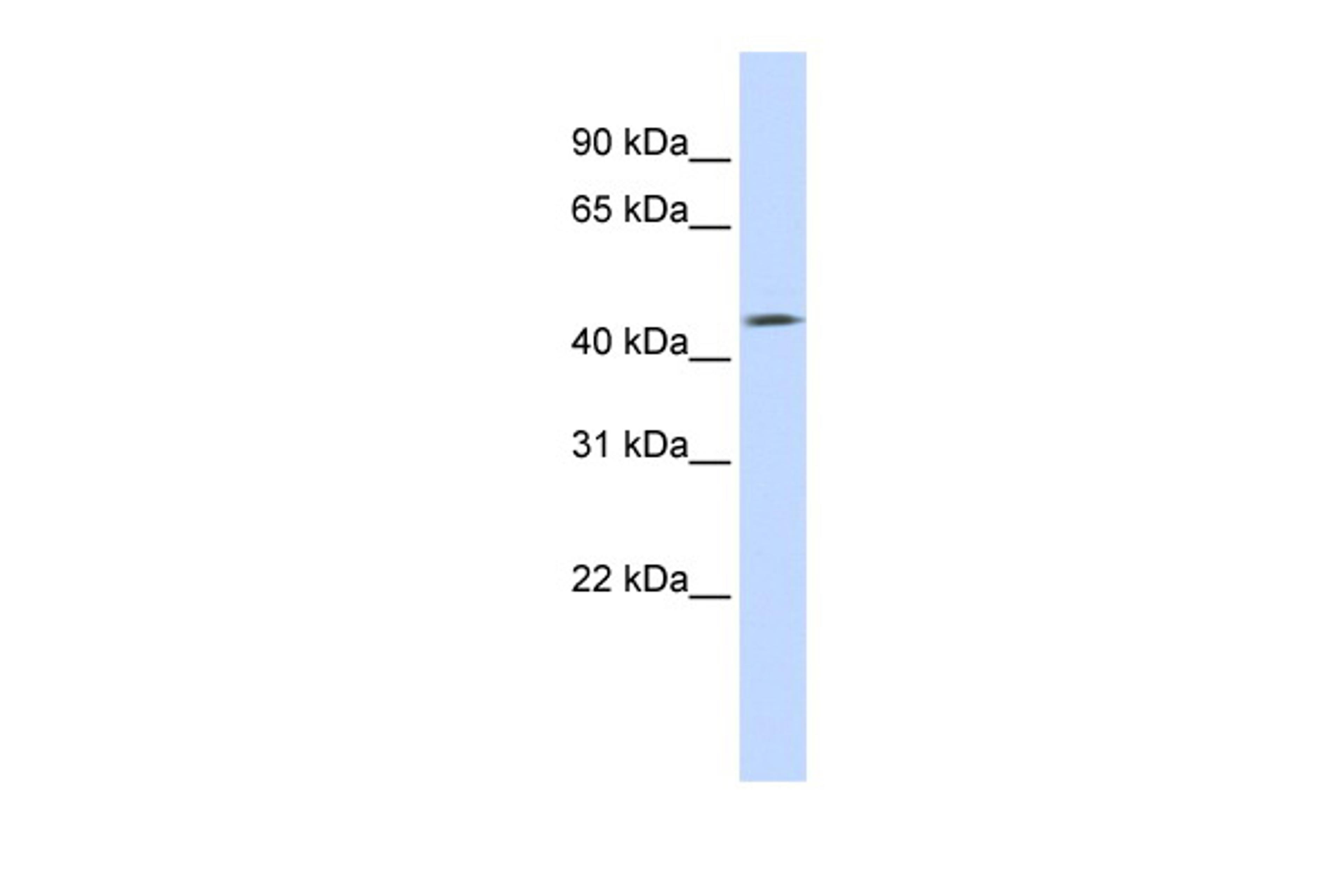 Antibody used in WB on Human Heart at 0.2-1 ug/ml.