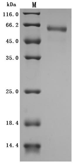 (Tris-Glycine gel) Discontinuous SDS-PAGE (reduced) with 5% enrichment gel and 15% separation gel. Predicted band size: 38.2 kDa Observed band size: (a) 68 kDa before EndoH Digestion (b) 38 kDa after EndoH Digestion