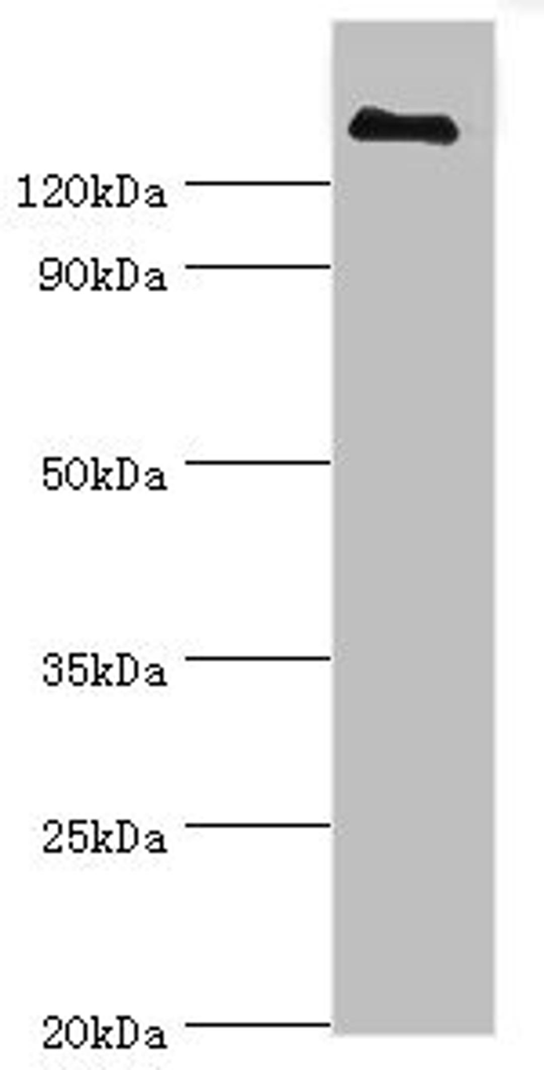 Western blot. All lanes: CFH antibody at 3µg/ml + human serum. Secondary. Goat polyclonal to rabbit IgG at 1/10000 dilution. Predicted band size: 140, 52 kDa. Observed band size: 140 kDa