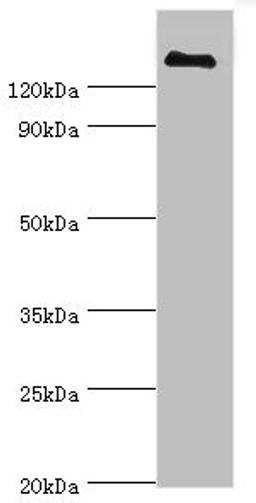 Western blot. All lanes: CFH antibody at 3µg/ml + human serum. Secondary. Goat polyclonal to rabbit IgG at 1/10000 dilution. Predicted band size: 140, 52 kDa. Observed band size: 140 kDa