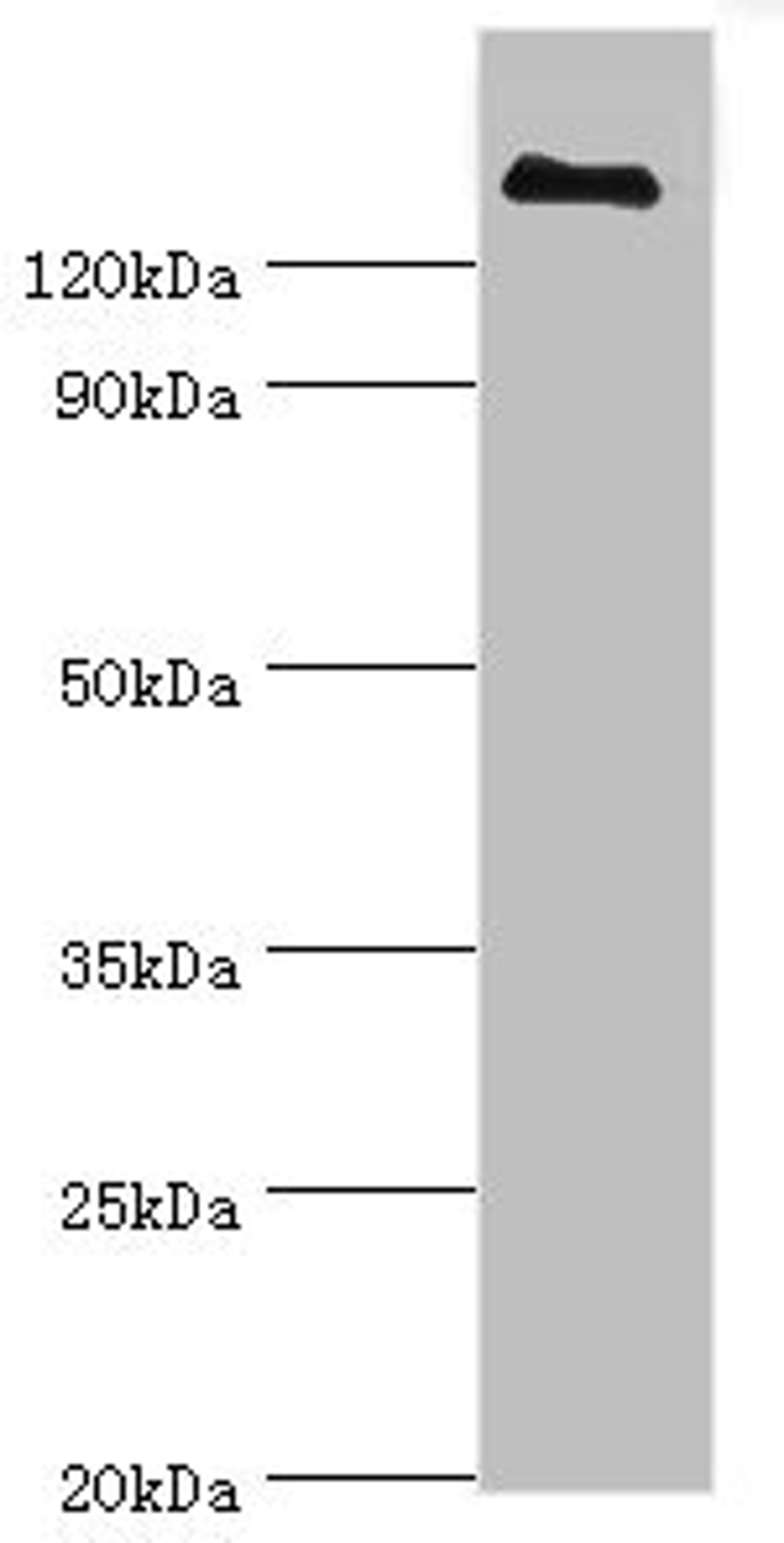 Western blot. All lanes: CFH antibody at 3µg/ml + human serum. Secondary. Goat polyclonal to rabbit IgG at 1/10000 dilution. Predicted band size: 140, 52 kDa. Observed band size: 140 kDa