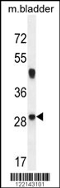 Western blot analysis in mouse bladder tissue lysates (35ug/lane).