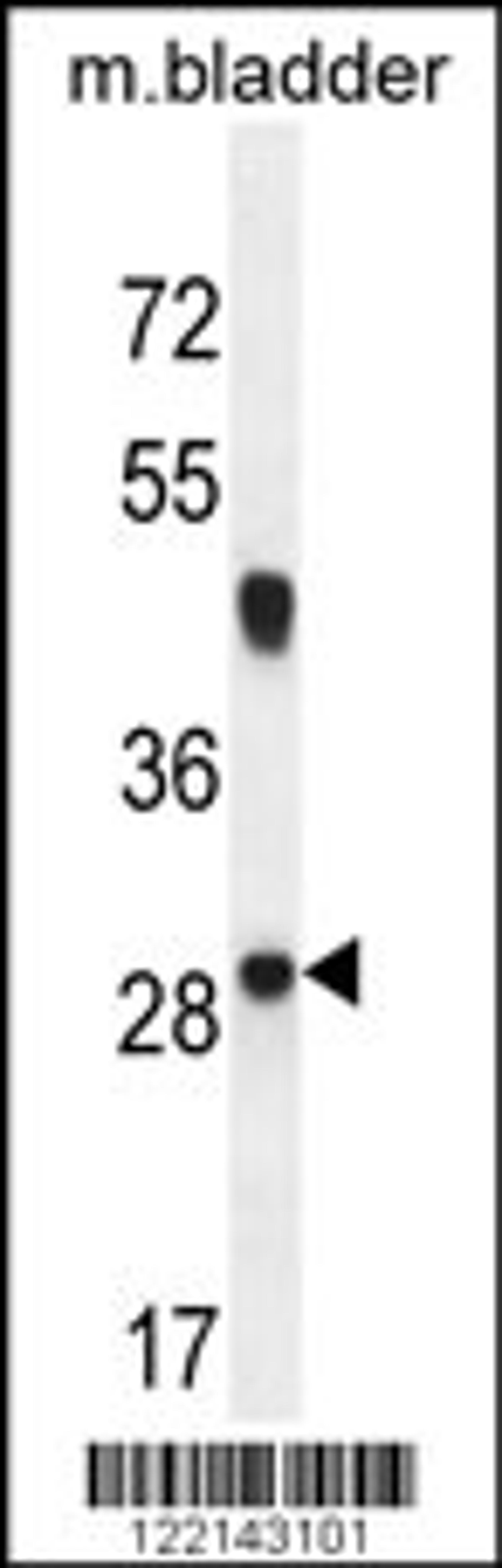 Western blot analysis in mouse bladder tissue lysates (35ug/lane).