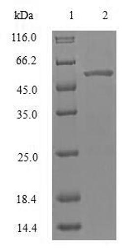 (Tris-Glycine gel) Discontinuous SDS-PAGE (reduced) with 5% enrichment gel and 15% separation gel.