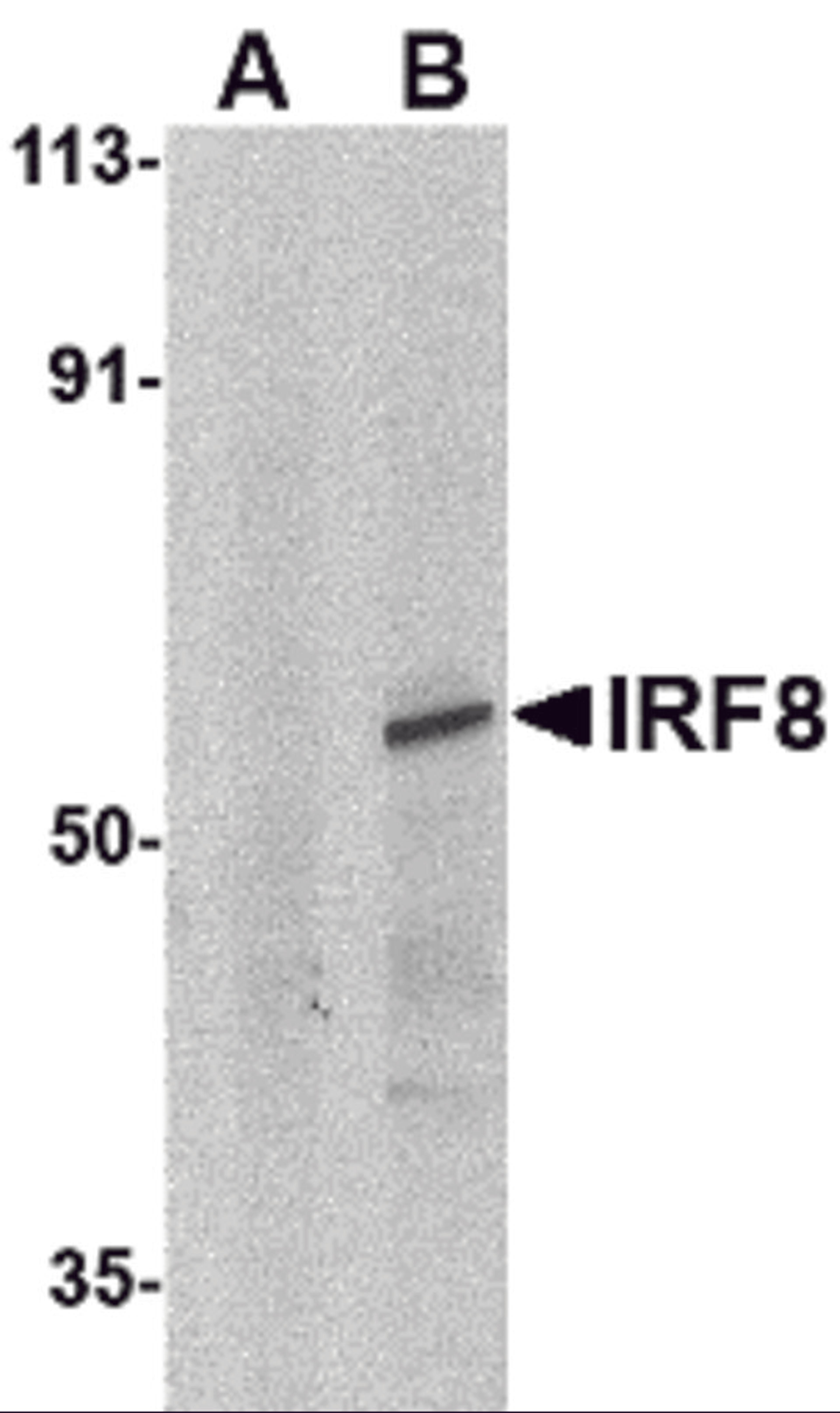 Western blot analysis of IRF8 in human thymus tissue lysate with IRF8 antibody at 1μg/mL in (A) the presence and (B) absence of blocking peptide.