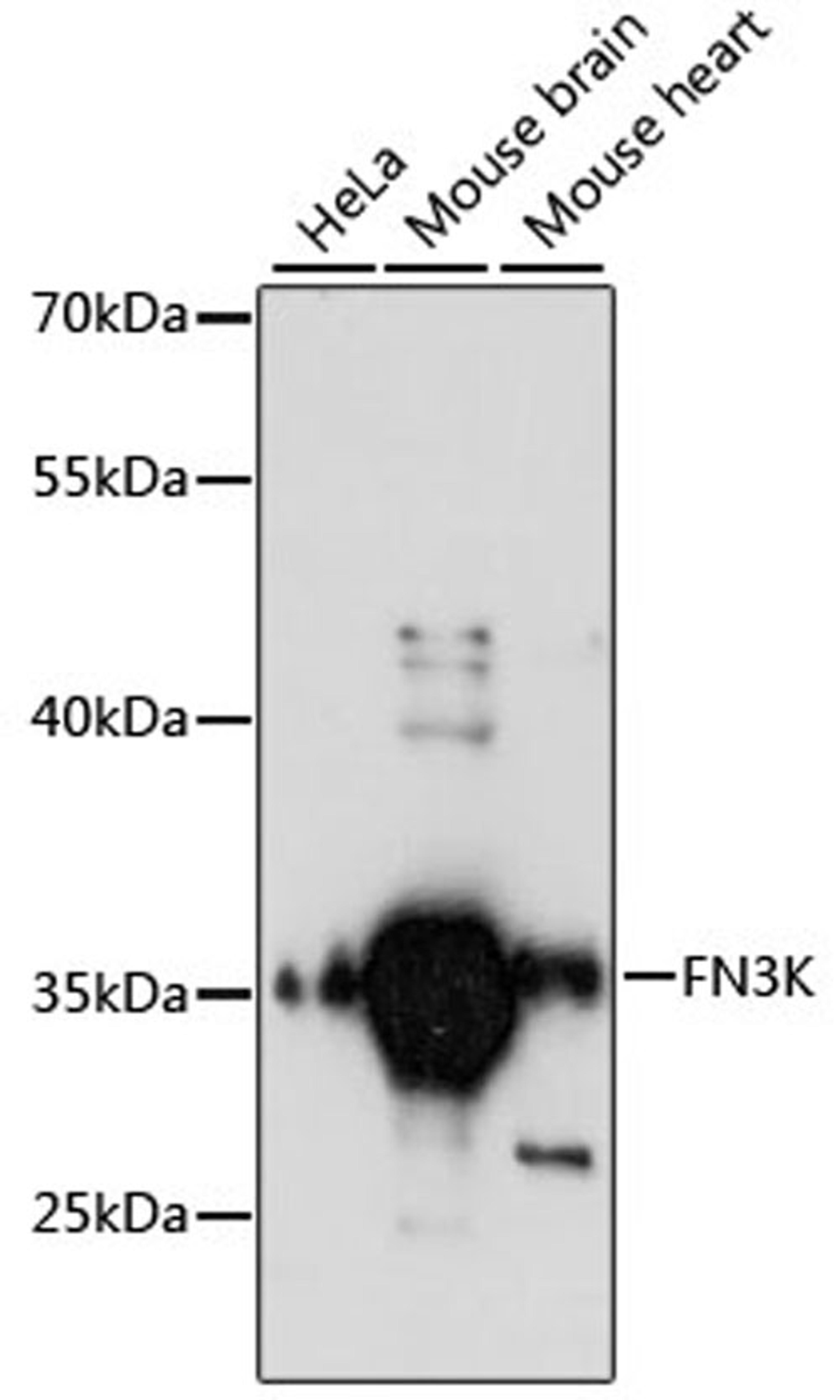 Western blot - FN3K antibody (A13727)