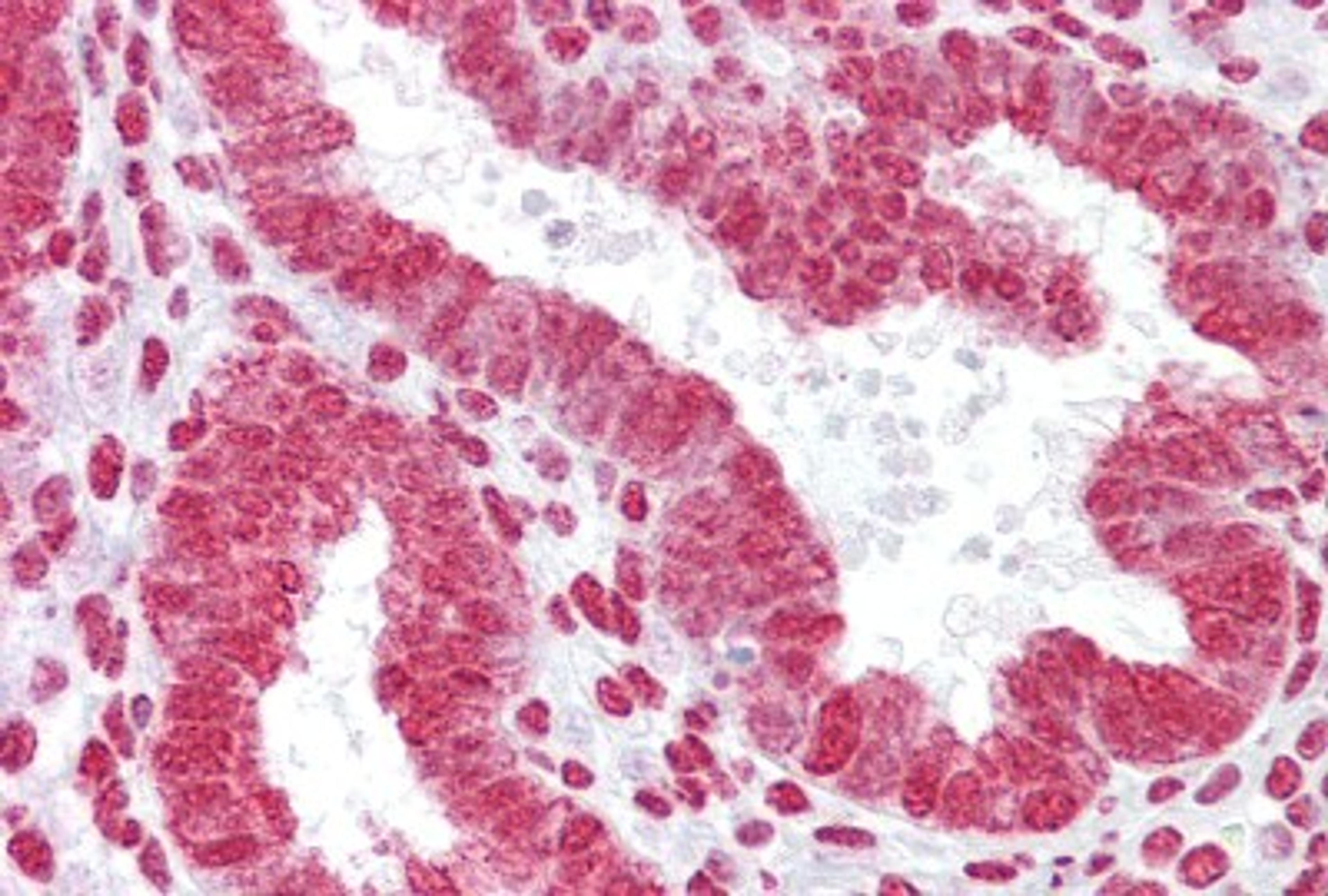 Immunohistochemistry-Paraffin: HOXA11 Antibody [NBP1-80228] - Human Uterus Tissue, 4-8ug/ml.