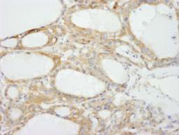 Detection of human NF2 isoform 1 by immunohistochemistry.