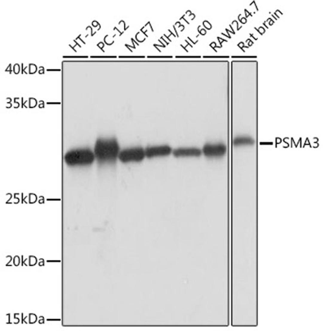 Western blot - PSMA3 Rabbit mAb (A5094)