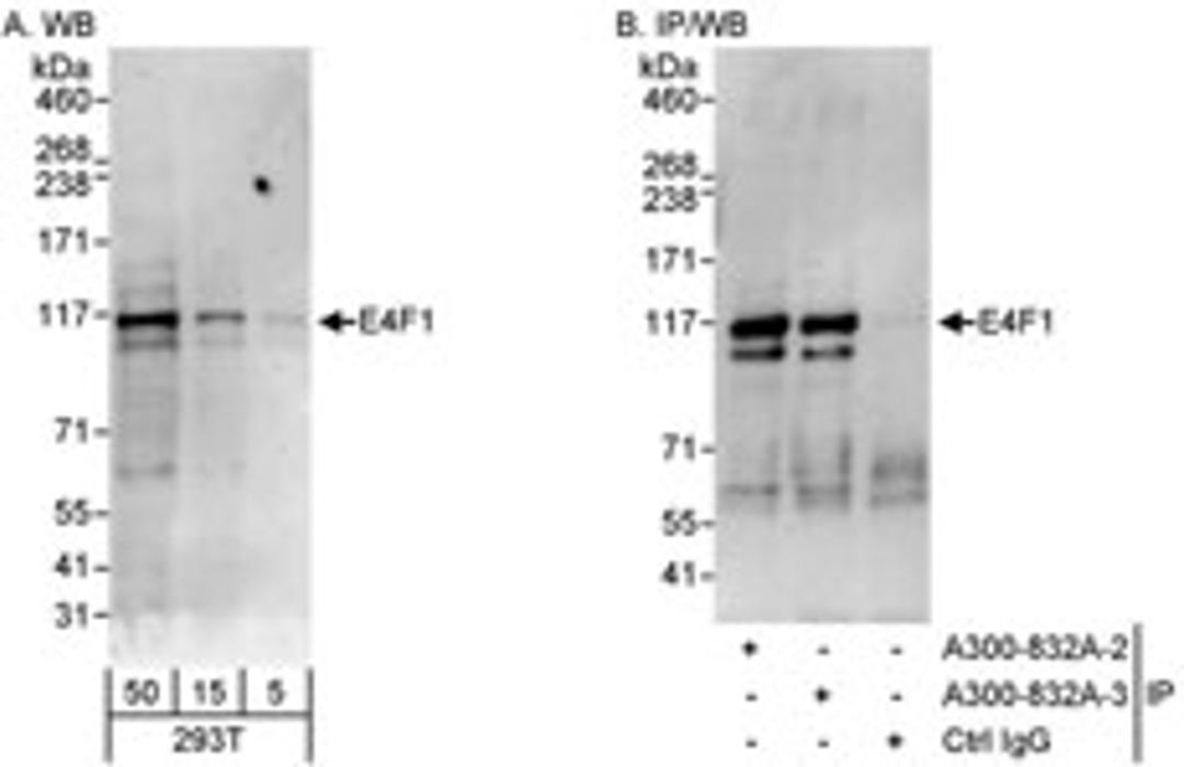 Detection of human E4F1 by western blot and immunoprecipitation.