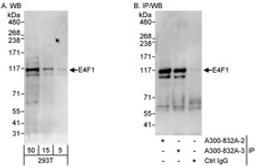 Detection of human E4F1 by western blot and immunoprecipitation.