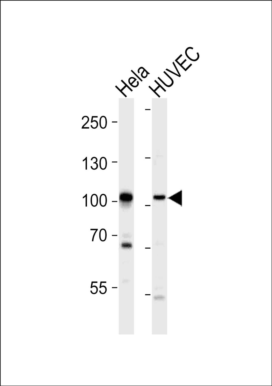 Western blot analysis of lysates from Hela, HUVEC cell line (from left to right), using EPHA4 Antibody (R890) at 1:1000 at each lane.