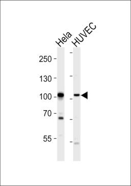 Western blot analysis of lysates from Hela, HUVEC cell line (from left to right), using EPHA4 Antibody (R890) at 1:1000 at each lane.