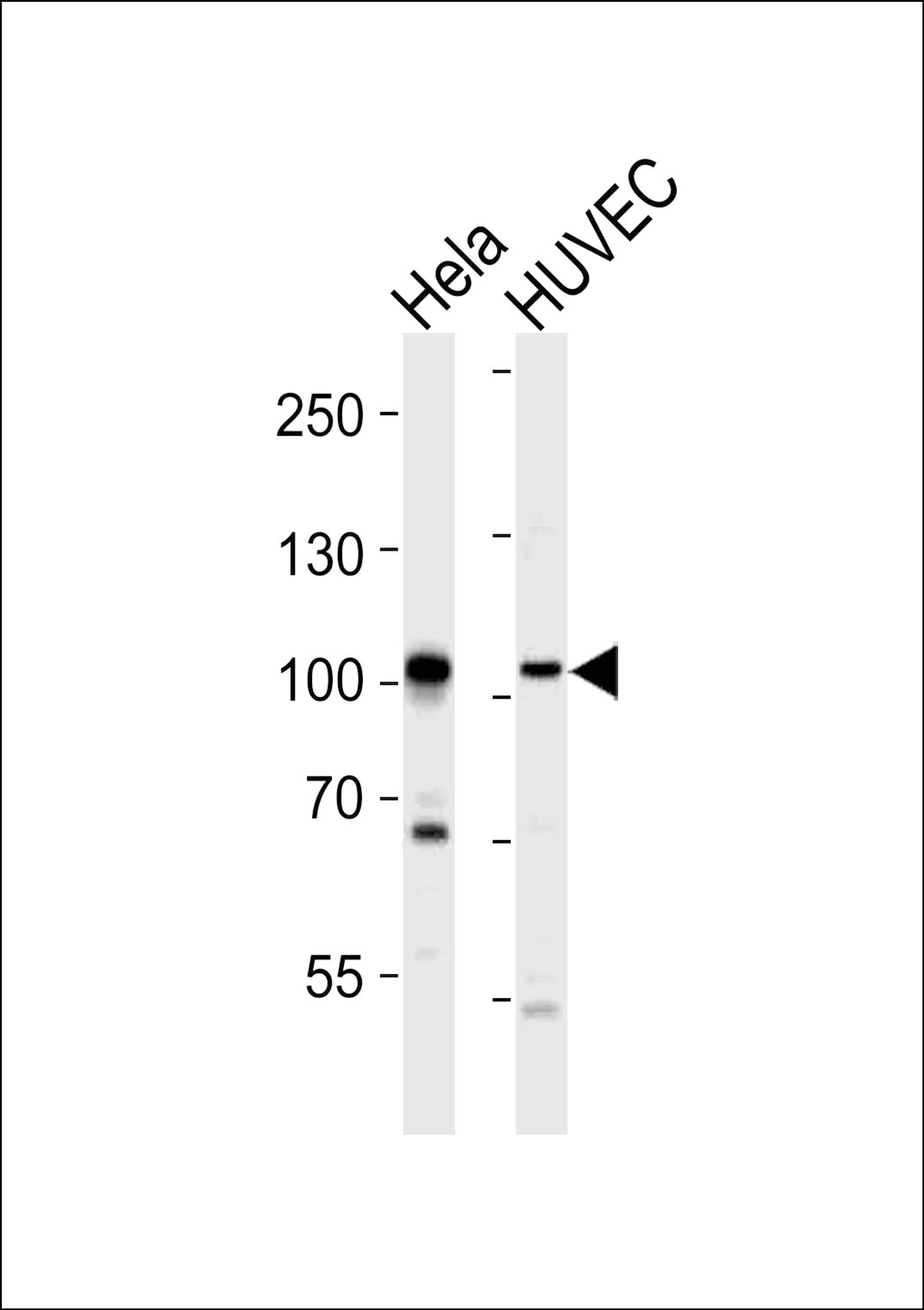 Western blot analysis of lysates from Hela, HUVEC cell line (from left to right), using EPHA4 Antibody (R890) at 1:1000 at each lane.