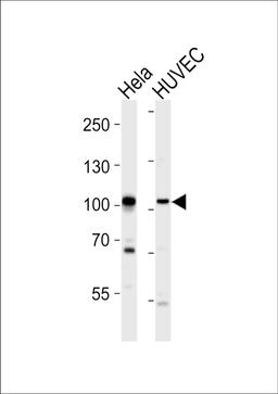 Western blot analysis of lysates from Hela, HUVEC cell line (from left to right), using EPHA4 Antibody (R890) at 1:1000 at each lane.