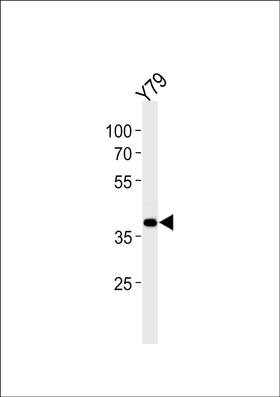 Western blot analysis in Y79 cell line lysates (35ug/lane).