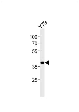 Western blot analysis in Y79 cell line lysates (35ug/lane).