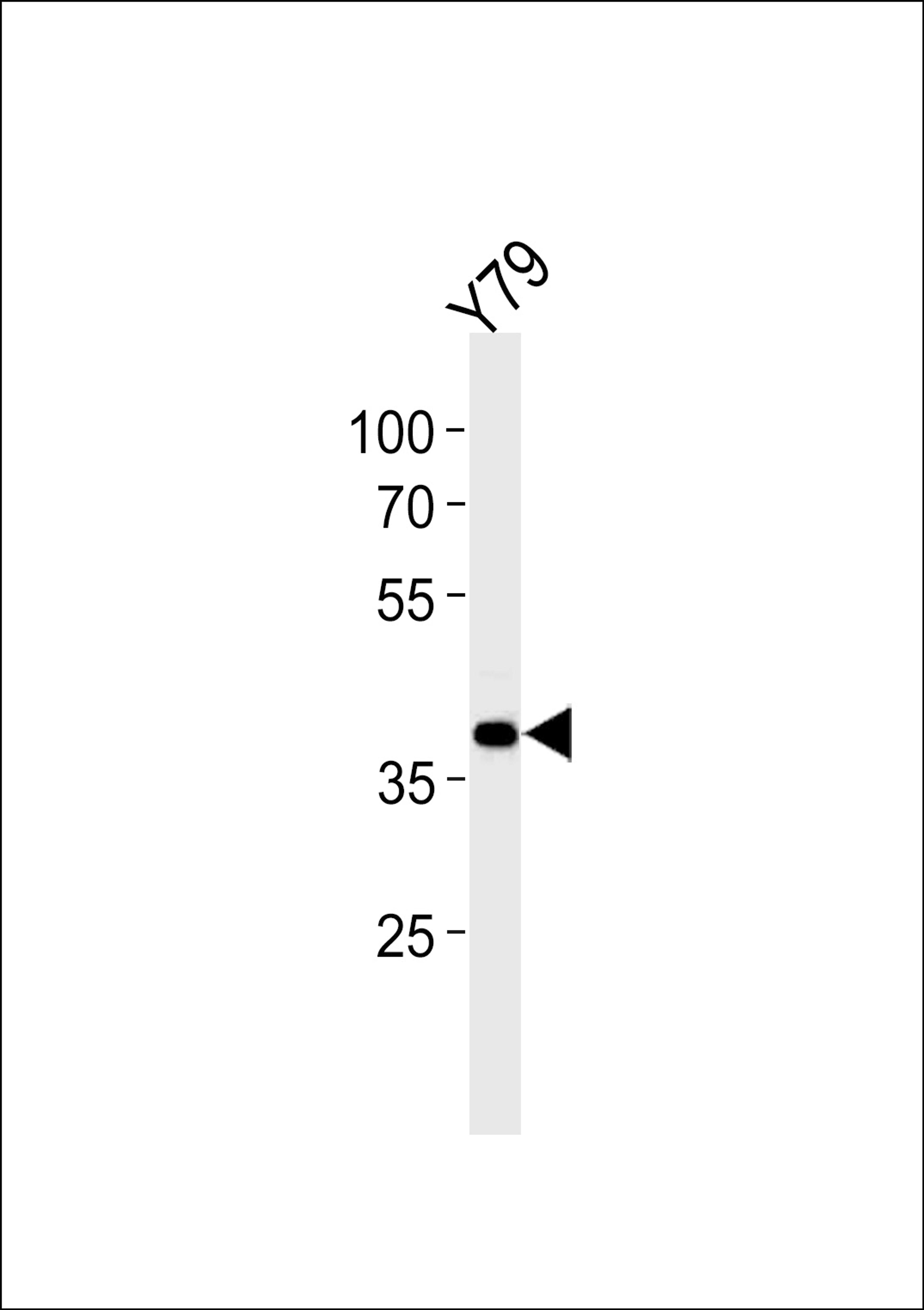 Western blot analysis in Y79 cell line lysates (35ug/lane).