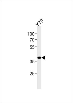 Western blot analysis in Y79 cell line lysates (35ug/lane).