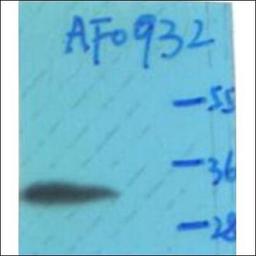 Western blot analysis of MCF7 whole cell lysates using Cyclin D1 -Phospho-Thr286- antibody