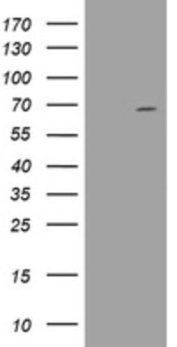 Western Blot: DDX59 Antibody (2G1) [NBP2-46447] - Analysis of HEK293T cells were transfected with the pCMV6-ENTRY control (Left lane) or pCMV6-ENTRY DDX59.