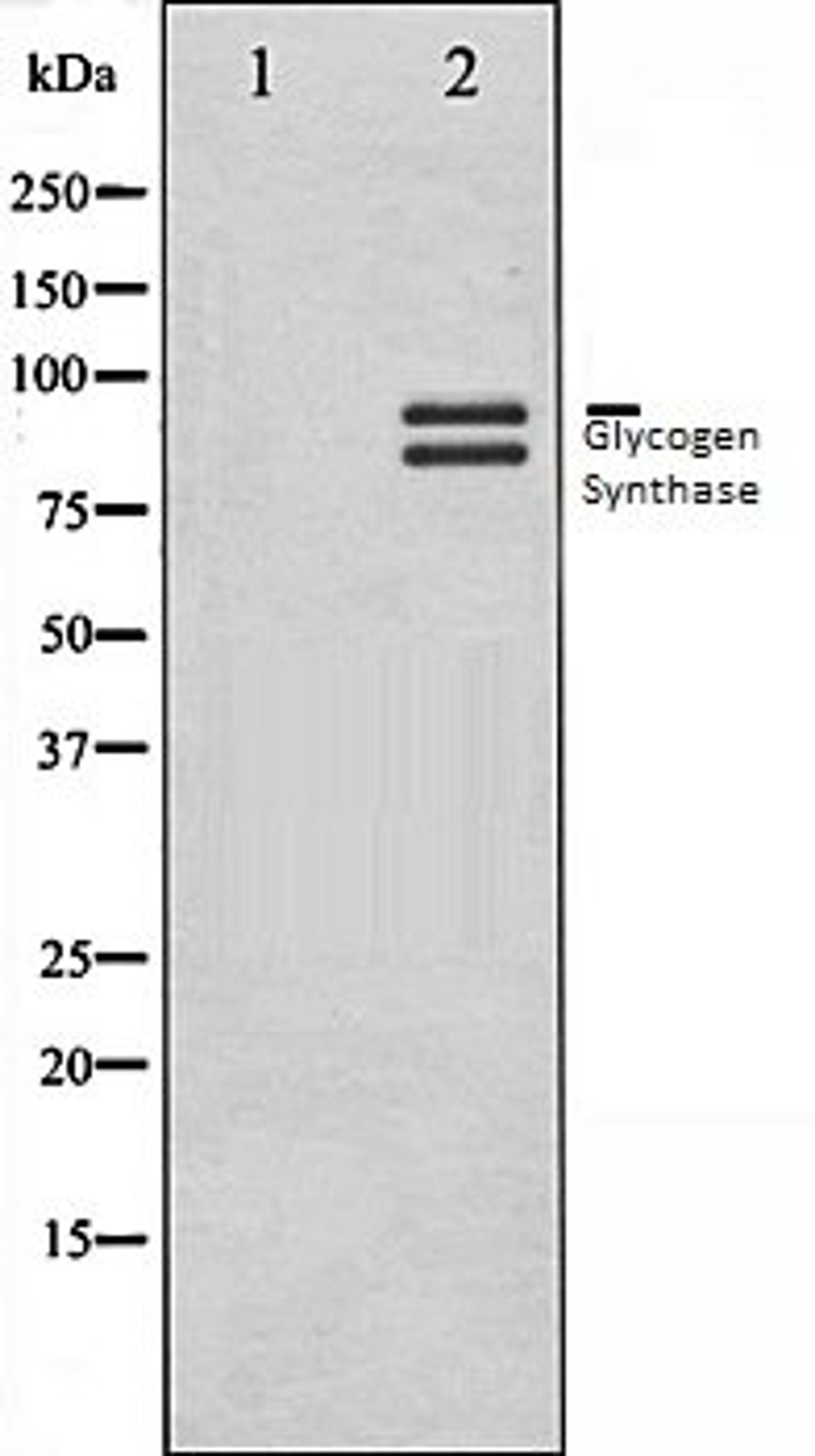 Western blot analysis of HeLa whole cell lysates using Glycogen Synthase antibody, The lane on the left is treated with the antigen-specific peptide.