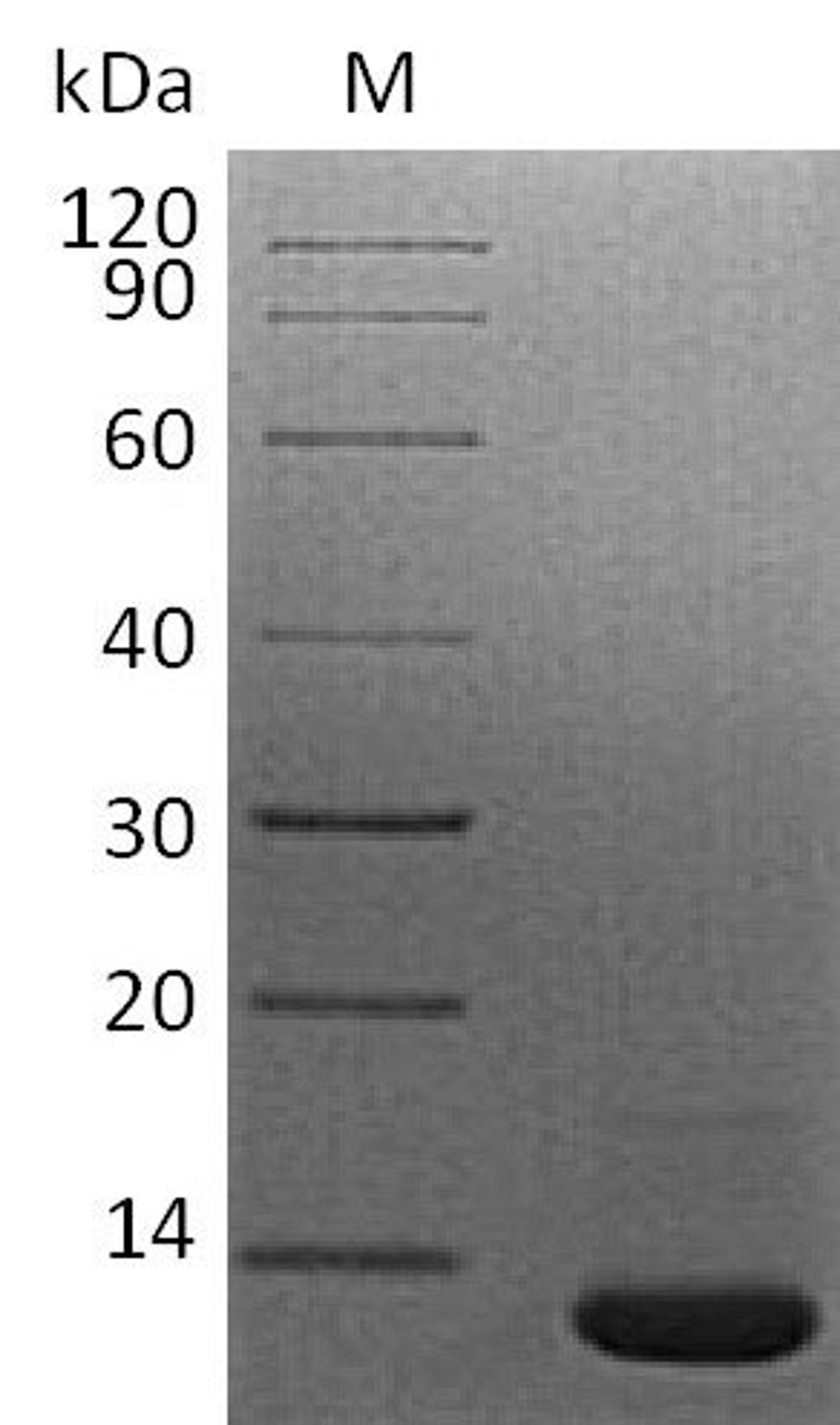 (Tris-Glycine gel) Discontinuous SDS-PAGE (reduced) with 5% enrichment gel and 15% separation gel.