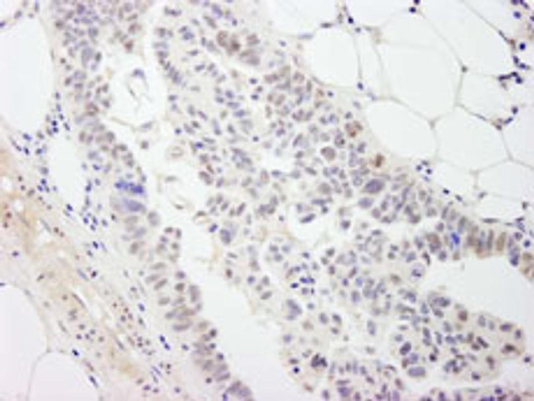 Detection of human DDX54 by immunohistochemistry.