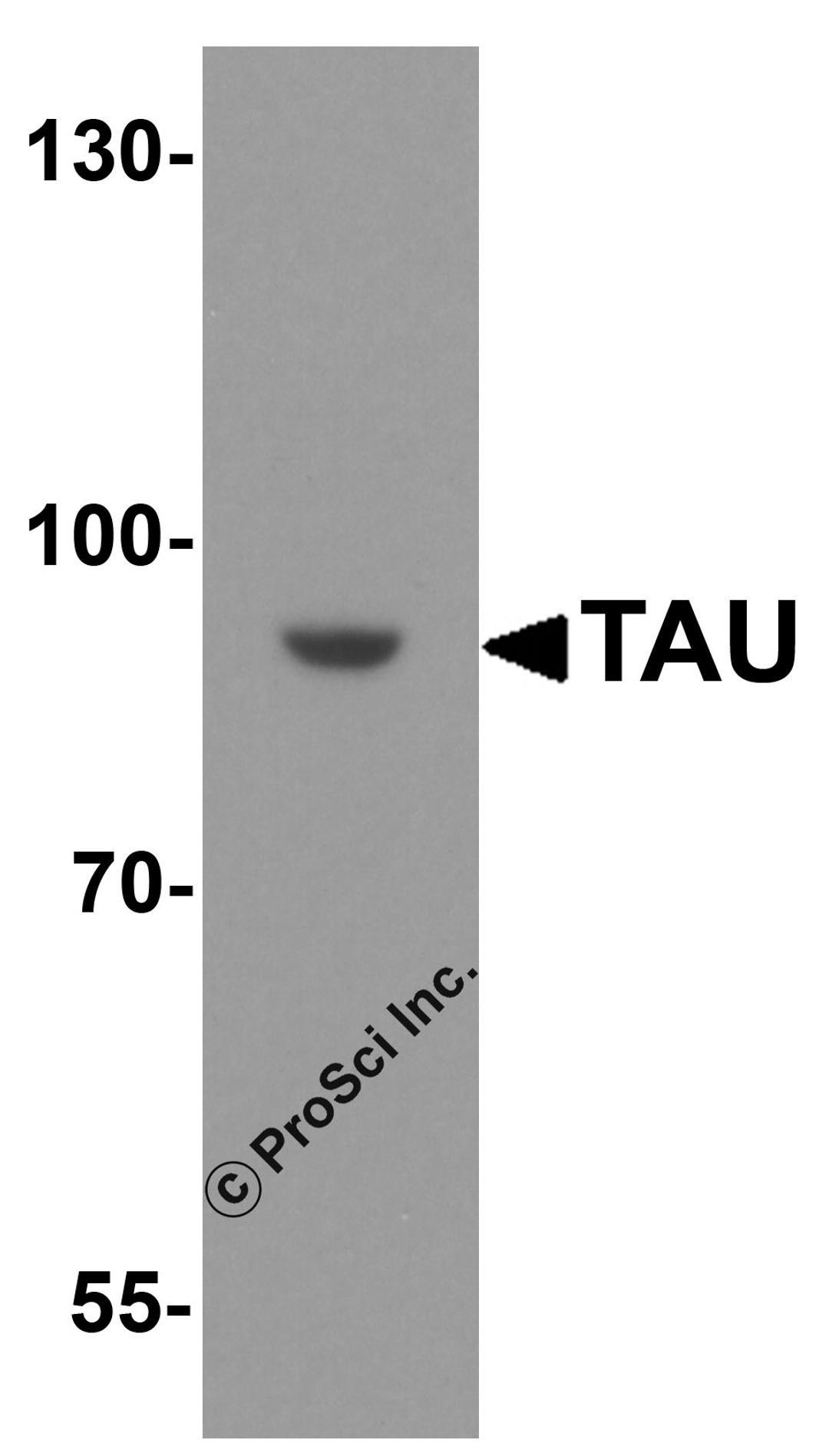 Western blot analysis of TAU in SK-N-SH cell lysate with TAU antibody at 1 μg/ml.