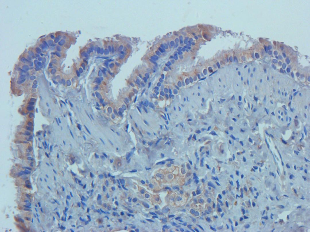 IHC-P staining of rat lung tissue using anti-CD14 (2.5 ug/ml)