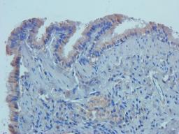 IHC-P staining of rat lung tissue using anti-CD14 (2.5 ug/ml)